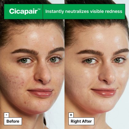Dr Jart+ Cicapair Tiger Grass Color Correcting Treatment